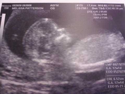 002 It's a Girl!